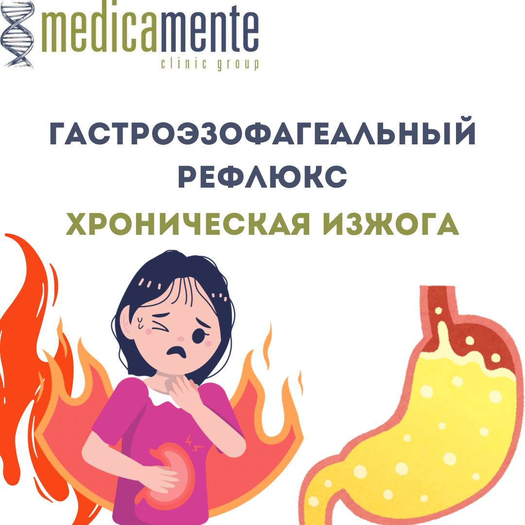 Гастроэзофагеальный рефлюкс - Хроническая изжога